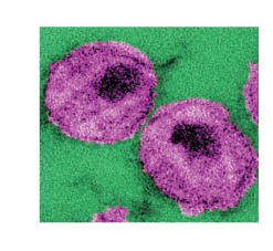 Imagen: Científicos de EE UU confirman el descubrimiento de un nuevo retrovirus